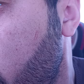 Otobüste Şiddet Ve İhmalkarlık