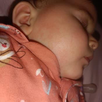 Güvenerek Aldığım Yüz Kremi Bebeğimin Cildini Tahriş Etti