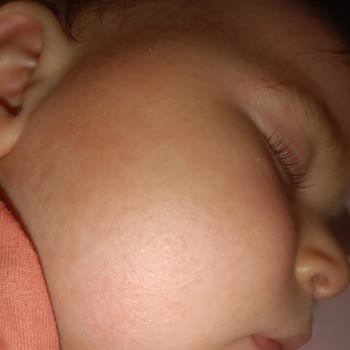 Güvenerek Aldığım Yüz Kremi Bebeğimin Cildini Tahriş Etti