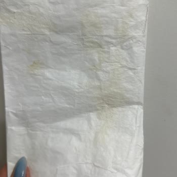 Uçuş Sonrası Hasarlı Bagaj Ve Kötü Hizmet Deneyimi