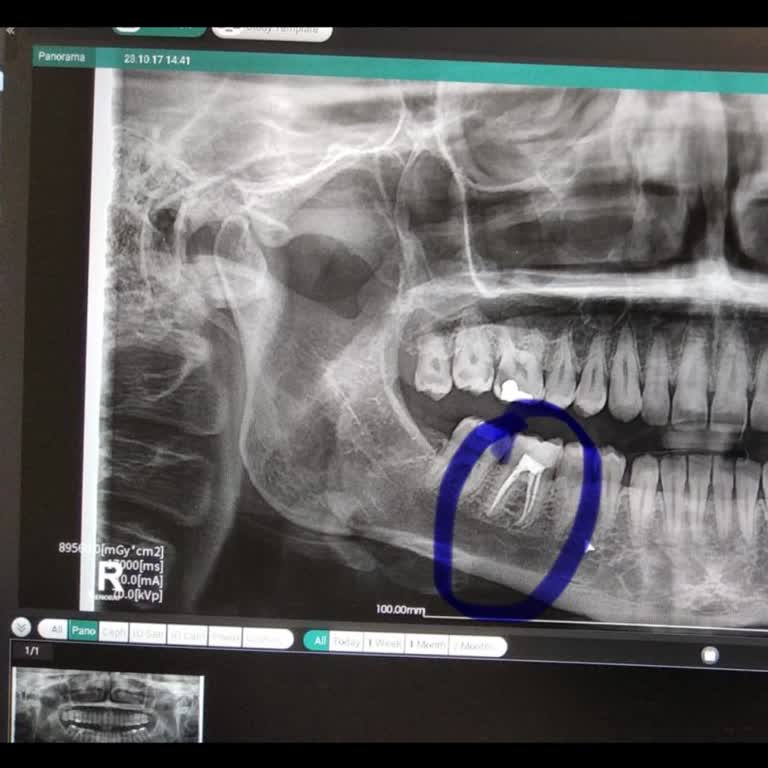 Dentomega Diş Kliniği'nde Hata