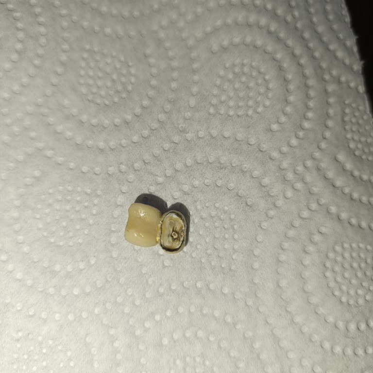 Beyaz Işık Diş Poliklinikleri Diş Tedavisinde Yaşanan Büyük Hayal Kırıklığı