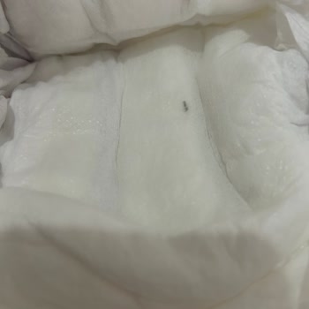 Bebek Bezinde Şüpheli Siyah Parça