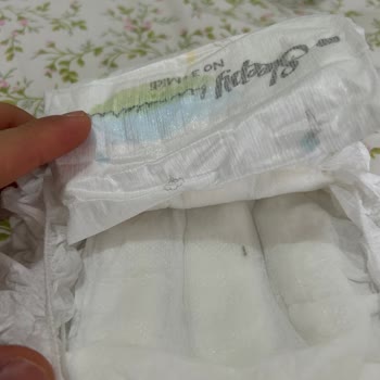 Bebek Bezinde Şüpheli Siyah Parça