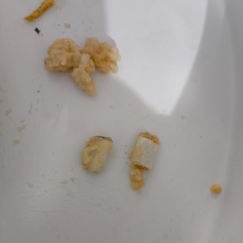 A101 Marketten Aldığım Ekmekte Sigara İzmariti Şoku