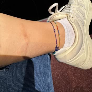 FLO Mağazasında Aldığım Bot Ayağımı Yaraladı