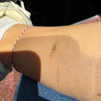 FLO Mağazasında Aldığım Bot Ayağımı Yaraladı