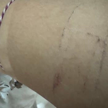 FLO Mağazasında Aldığım Bot Ayağımı Yaraladı