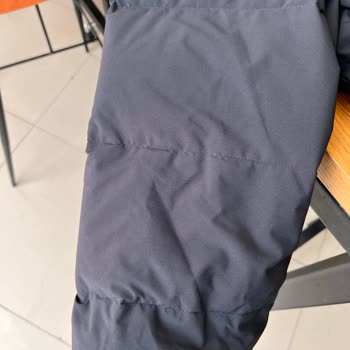 Adidas Montun Tüy Atma Sorunu Ve İade Reddi