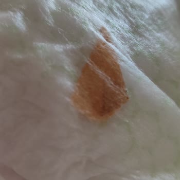 Bebek Bezinde Şok Edici Buluntu