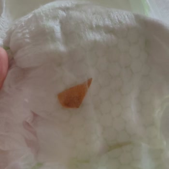 Bebek Bezinde Şok Edici Buluntu