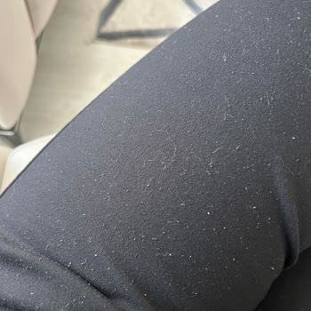 Hızla Eskimeye Yüz Tutan Eşofman Altı