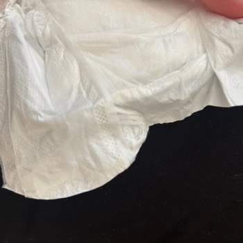 Sleepy Bebek Bezi: Hayal Kırıklığı Ve Cilt Sorunları