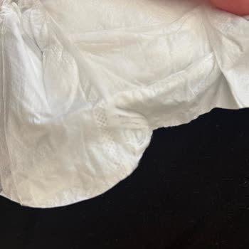 Sleepy Bebek Bezi: Hayal Kırıklığı Ve Cilt Sorunları