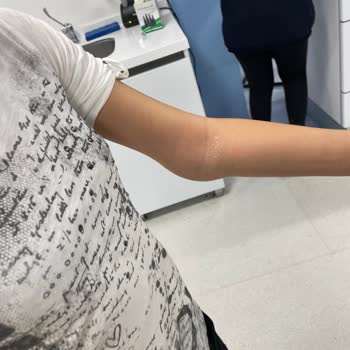 Güvenlik İhmali Sonucu Kızımın Kolu Kırıldı!