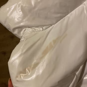 Calvin Klein Montun Sararma Ve Kalite Sorunları