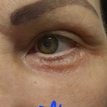 Okan Üniversitesi Hastanesi Başarısız Plastik Cerrahi Ve İletişimsizlik Sorunu