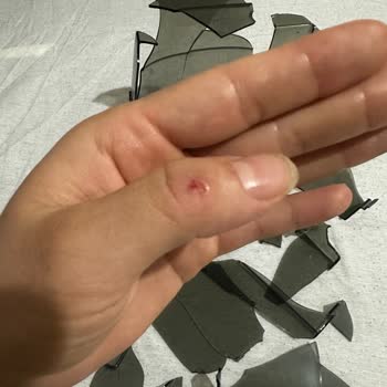 Kcc4325w Model Halı Yıkama Makinesi: Güvenlik Sorunu Ve Parçalanan Temiz Su Aparatı