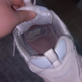 Skechers Ayakkabıda Beklenmedik Deformasyon Sorunu