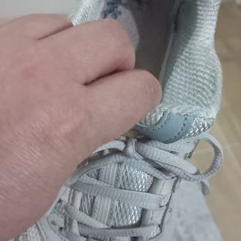 Skechers Ayakkabıda Beklenmedik Deformasyon Sorunu