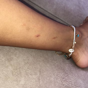 Es-derm Beauty Wellness İşletmesinden Memnun Kalmadık