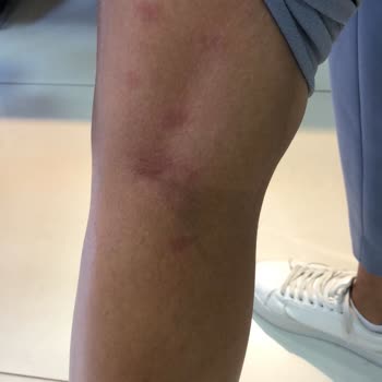 Es-derm Beauty Wellness İşletmesinden Memnun Kalmadık