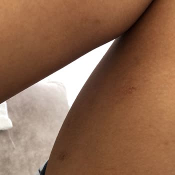 Es-derm Beauty Wellness İşletmesinden Memnun Kalmadık