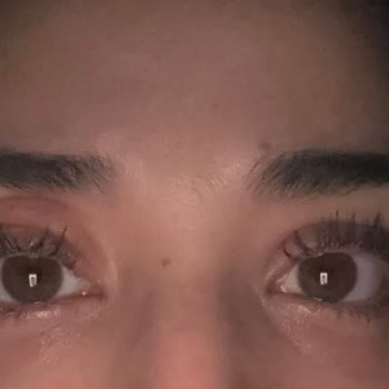 Epilady Sultanbeyli'de Tahriş Ve İlgisizlik Sorunu