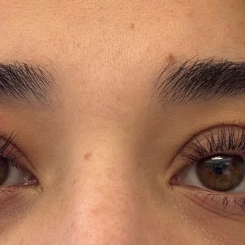 Epilady Sultanbeyli'de Tahriş Ve İlgisizlik Sorunu