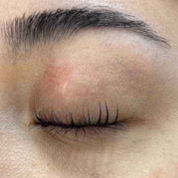 Epilady Sultanbeyli'de Tahriş Ve İlgisizlik Sorunu