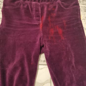 A101'de Sızdıran Ürün Ve İlgisiz Hizmet