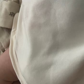 Molfix Sızdıran Ve Kullanılamayan Bebek Bezi Mağduriyeti