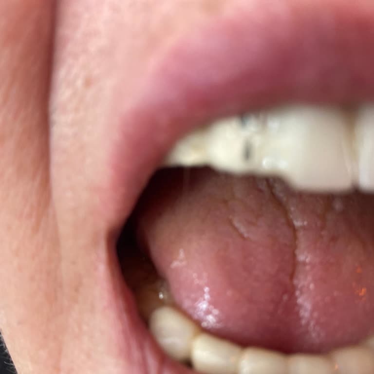 Kırılan Protezler Ve Saygısız Tavırlarla Hayal Kırıklığı