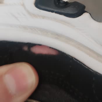 Skechers Ayakkabıda Üretim Kaynaklı Yırtılma Sorunu