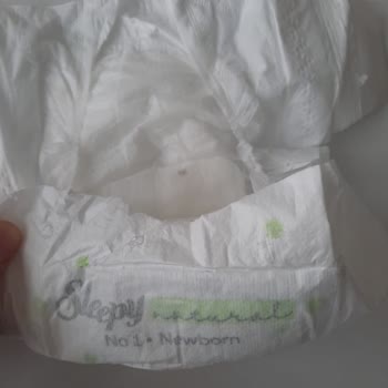 Bebek Bezinde Beklenmedik Sorun