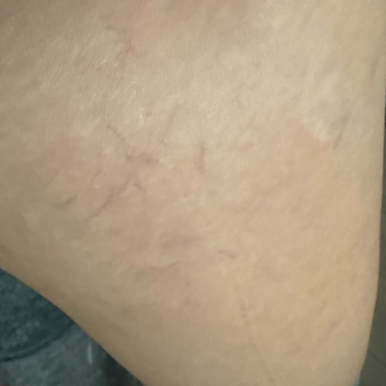 Yanlış Tedavi İle Artan Mağduriyet