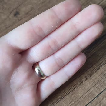 Ciltte Soyulma Ve Sivilce Yapan Krem Hayal Kırıklığı