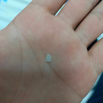 Üründe Plastik Parça Bulunması