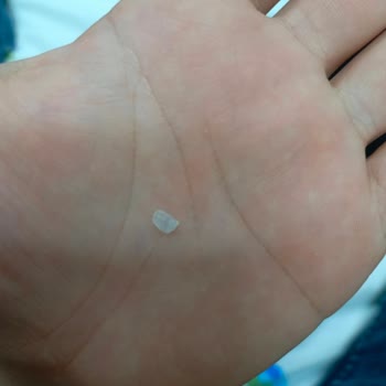 Üründe Plastik Parça Bulunması
