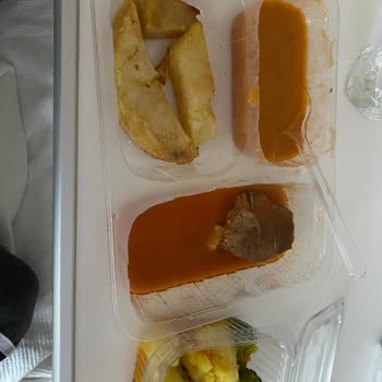 Ankara Bilkent Şehir Hastanesi Temizlik Yok!