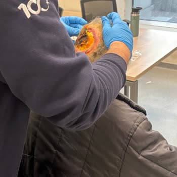 Acil Ameliyat Gereken Hastaya Yer Bulunamıyor