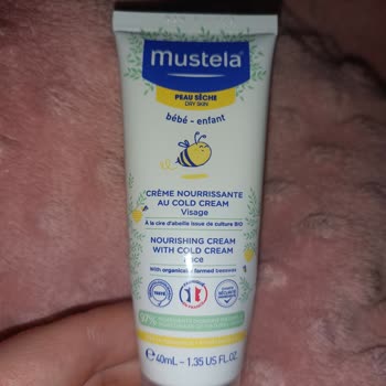 Mustela Face Cream Caused Severe Irritation on My Baby’s Skin