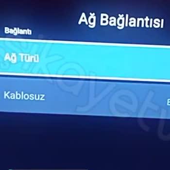 Onvo İnternete Bağlanma Sorunu!