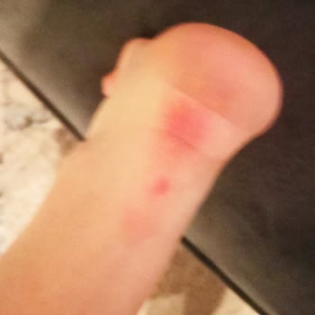 Greyder Botları Ayaklarımı Mahvetti Ve İade Sorunu Yaşıyorum