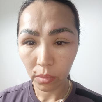 Yanlış Uygulama Sonucu Yaşanan Sağlık Sorunu