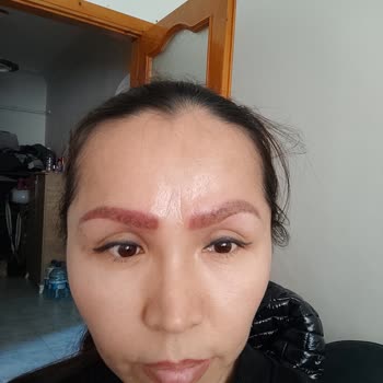 Yanlış Uygulama Sonucu Yaşanan Sağlık Sorunu