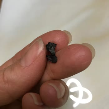 Livashop Pastasında Taş Sürprizi