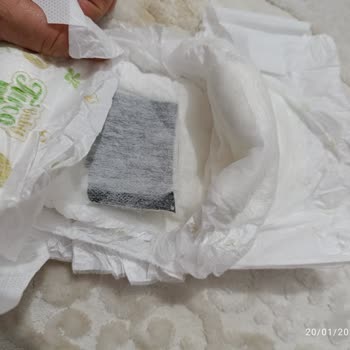 Bebek Bezi İçindeki Gizemli Siyah Bant Parçası