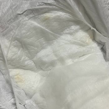 Bebek Bezi Kalitesizliği Ve Cilt Sorunları