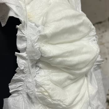 Bebek Bezi Kalitesizliği Ve Cilt Sorunları